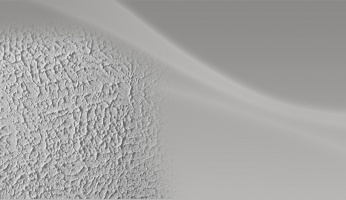 textured ceiling